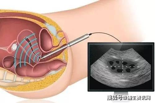 碳酸锂最新价格,最新上海门事件李雅,电池华为最新,碳酸锂最新价格动态及其对电池行业的影响——聚焦华为与上海门事件中的李雅